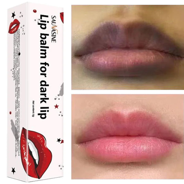 Lip-Balm-For-Remove-Dark-Lip-Moisturizing-Lightening-Melanin-Whitening-Plumper-Extreme-Gloss-Pink-Lips-Skin.jpg